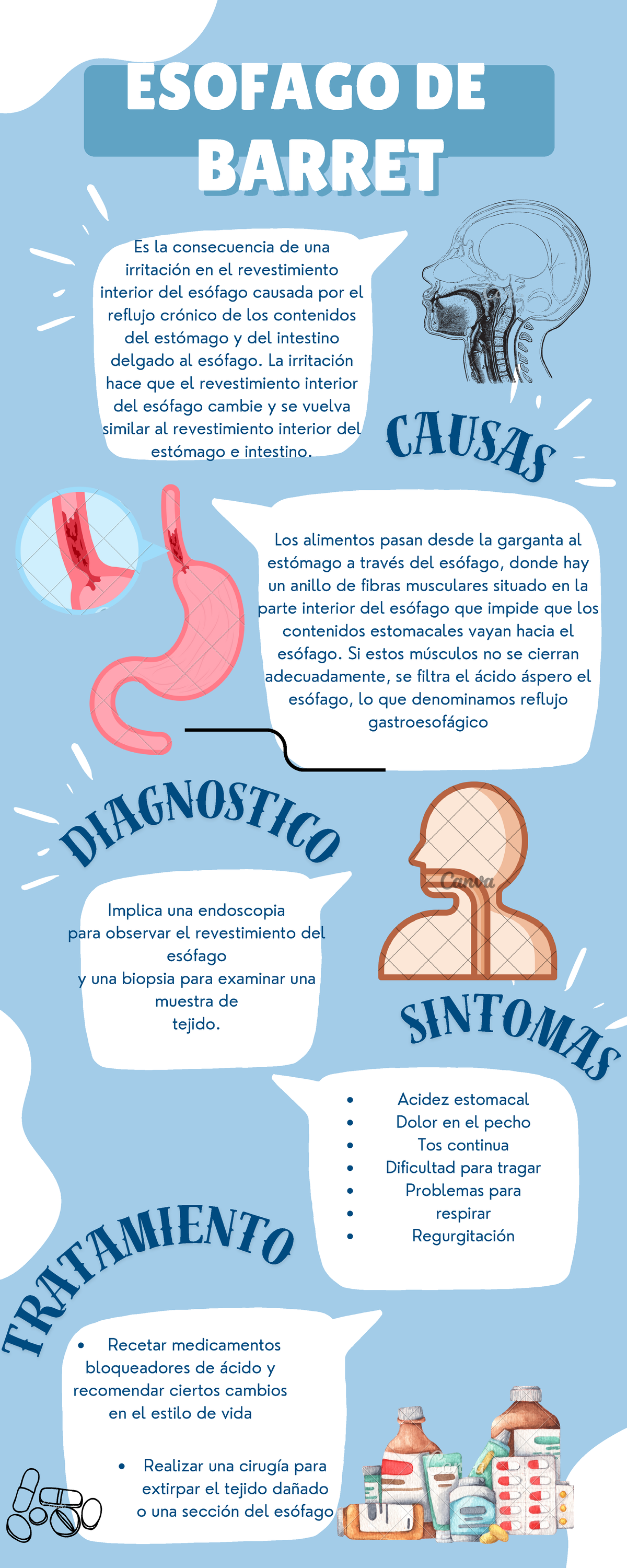 Esofago - Que es y causas - Acidez estomacal Dolor en el pecho Tos ...