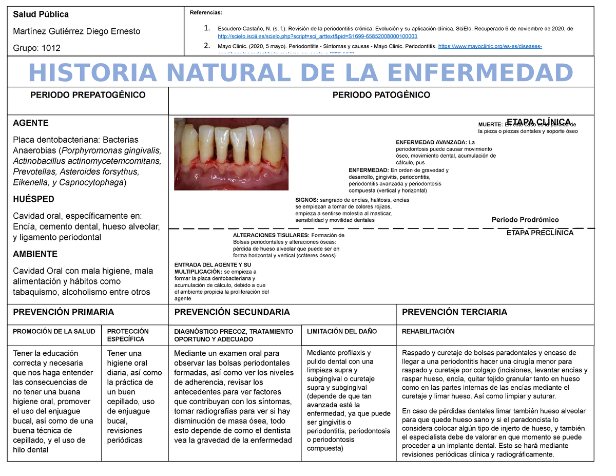 Historia Natural De La Enfermedad Periodontal 1 Ppt Powerpoint Otosection Porn Sex Picture 3392