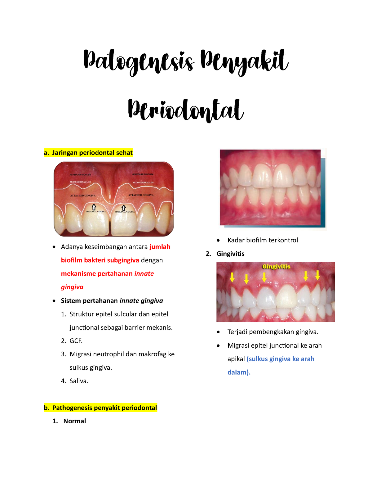 Patogenesis Penyakit Periodontal - A. Jaringan Periodontal Sehat ...