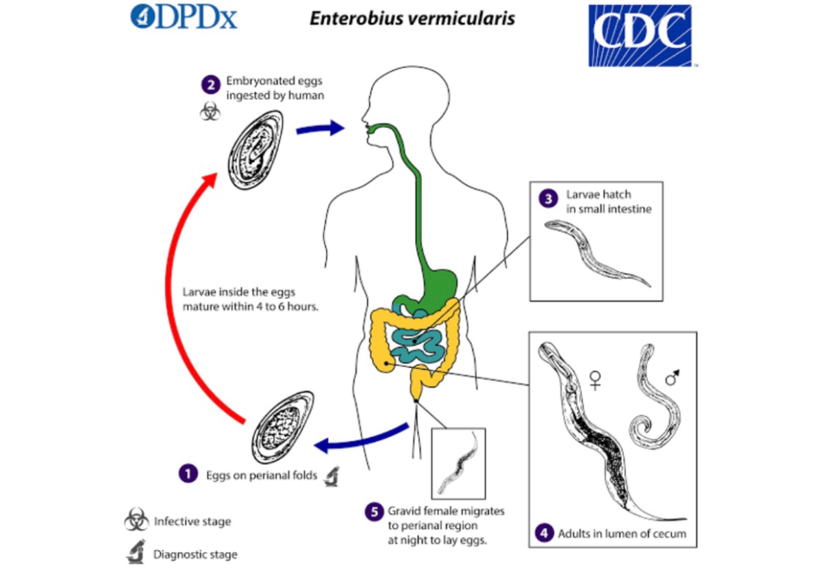 Entrobius Vermicularis - molecular biology - Studocu