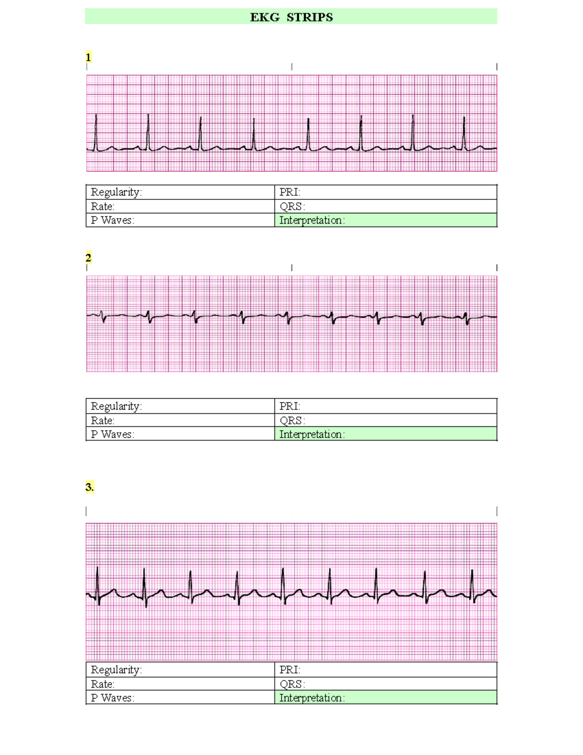 EKG+Strips+Nur+3290+2019 +1+st+set - EKG STRIPS 1 Regularity: PRI: Rate ...