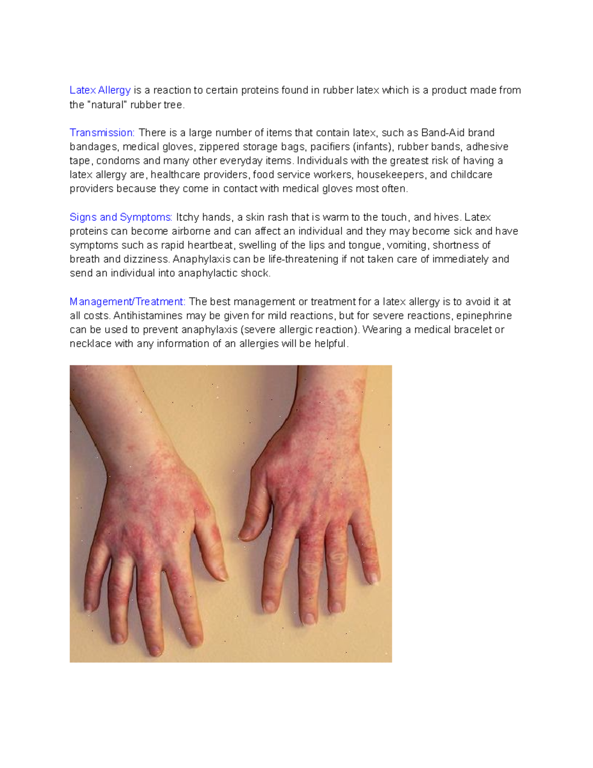 Latex Allergy, Symptoms, Testing & Treatment in St. Louis