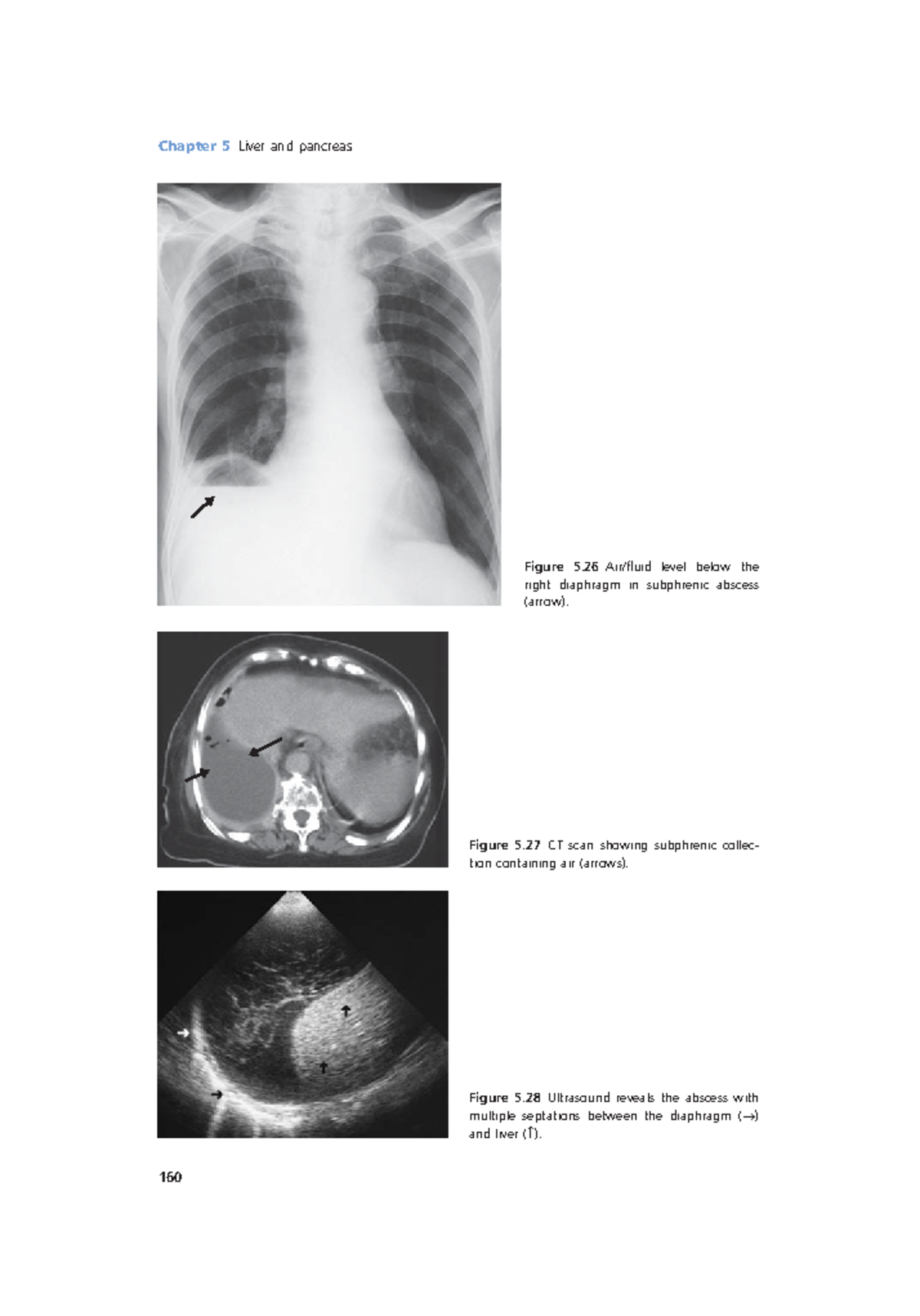 Radiology Lecture Notes pdf (54) - Chapter 5 Liver and pancreas 160 ...