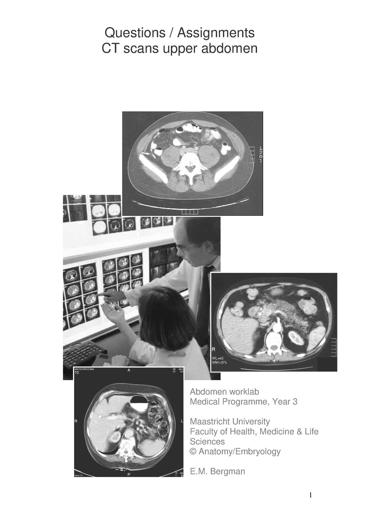 Assignments + CT Scans Upper Abdomen (anatomie) - Opdracht CTscan ...