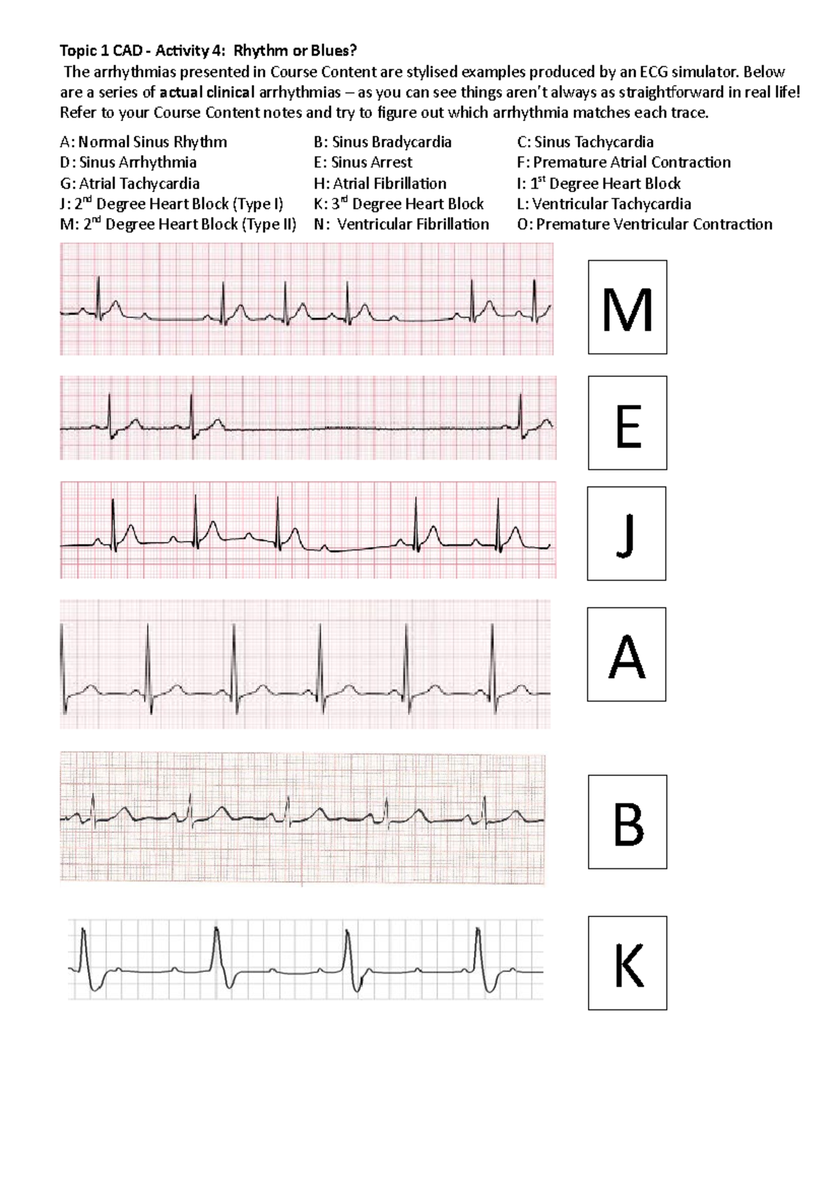 Activity 4 Arrhythmias For Lectorial Worksheet - Topic 1 Cad - Activity 