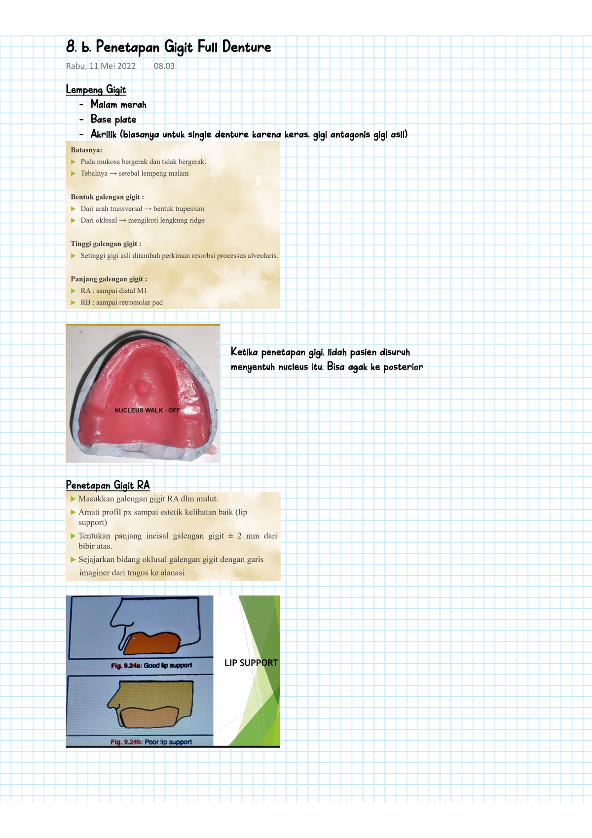 Prostodonsia II - 8. B. Penetapan Gigit Full Denture - Lempeng Gigit ...