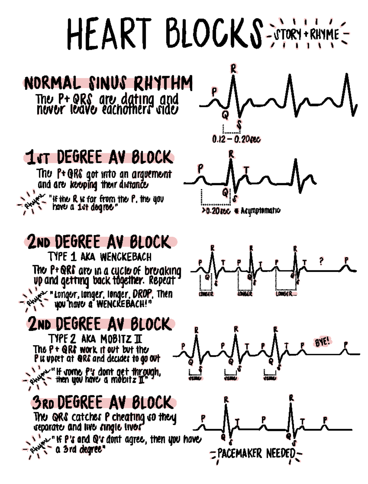 Nurse Steph s Complete Nursing Handbook 2 - I l l l l HEART BLOCKS ...