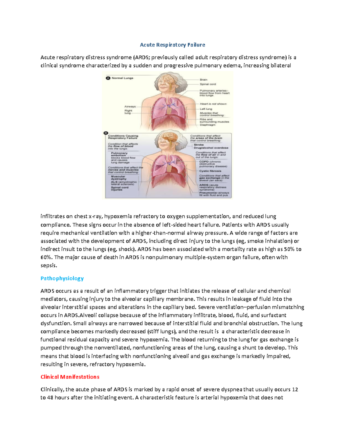 Acute Respiratory Failure - Acute Respiratory Failure Acute respiratory ...