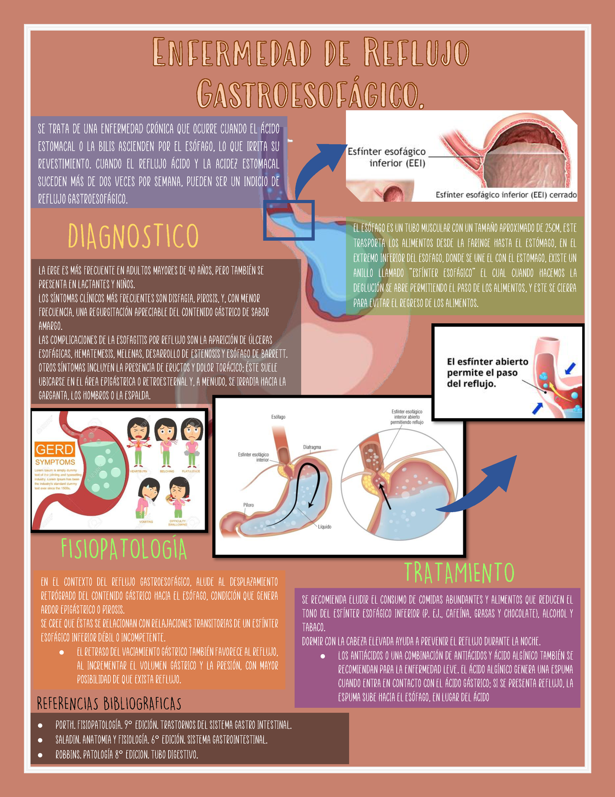 Infograf A De Enfermedad De Reflujo Gastroesof Gico Erge Se Trata De Una Enfermedad Cr Nica