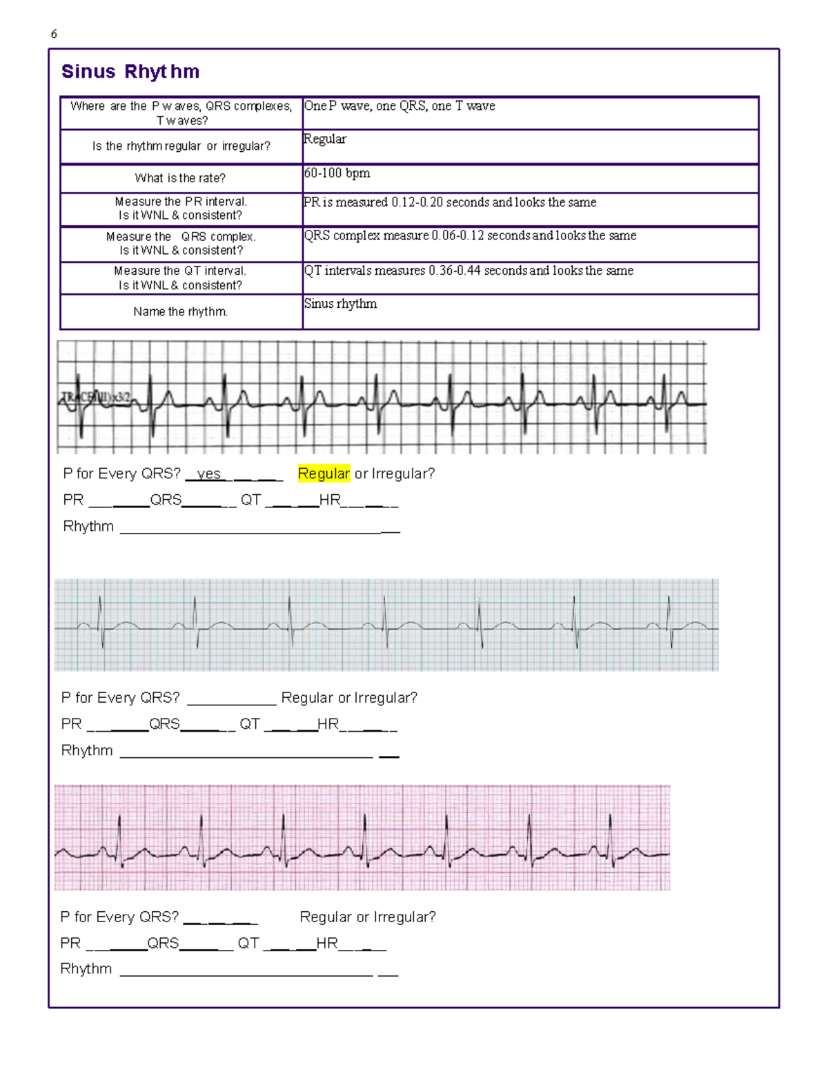 Page 6-14 Ecg Workbook - Sem104 - Studocu