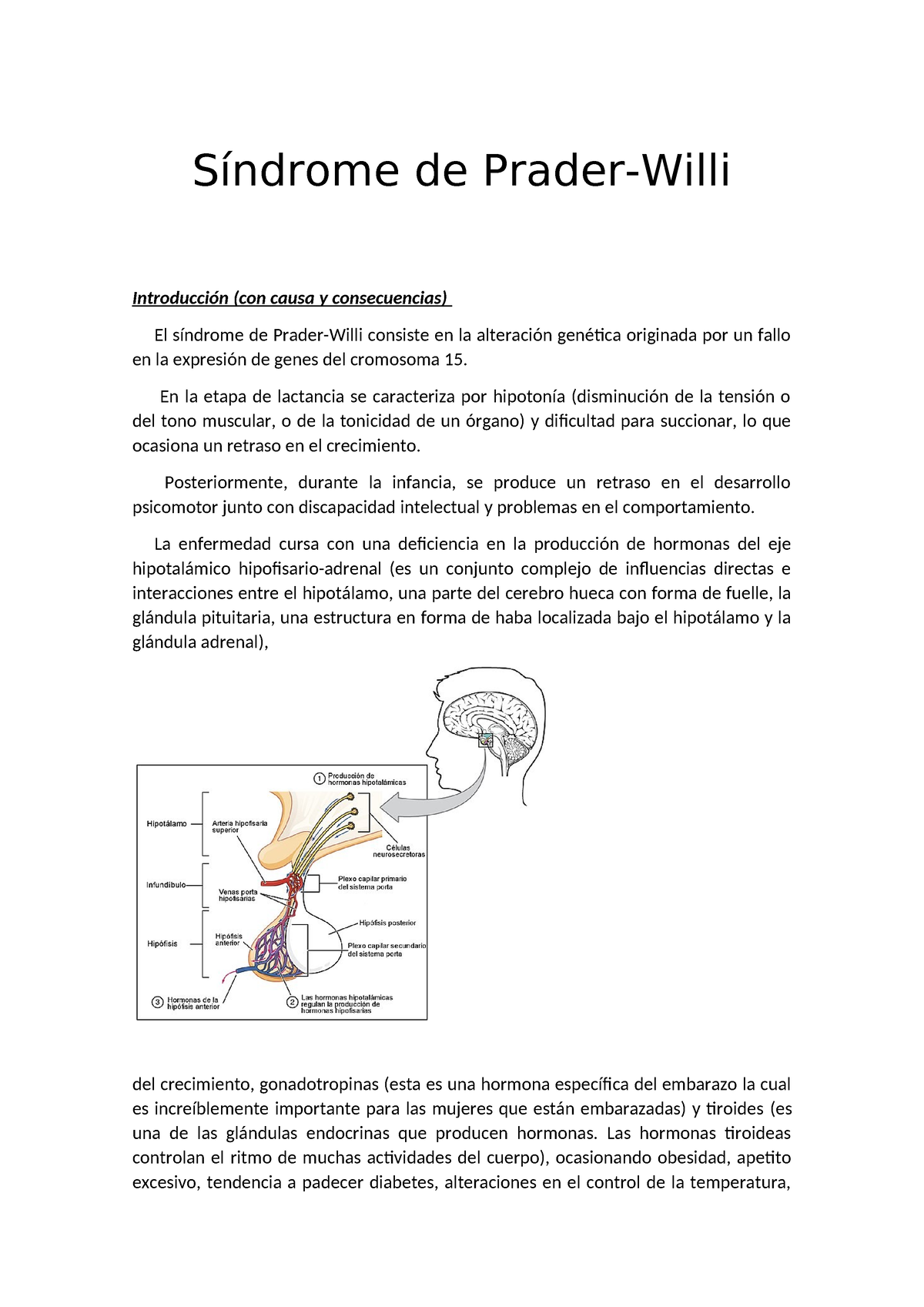 Sindrome De Prader Willi Síndrome De Prader Willi Introducción Con Causa Y Consecuencias El 6737