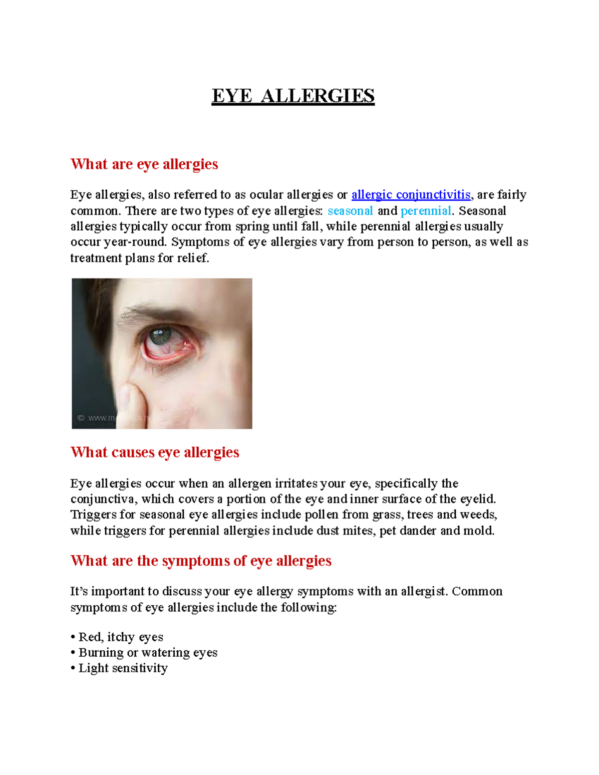 EYE Allergies Lecture notes EYE ALLERGIES What are eye allergies