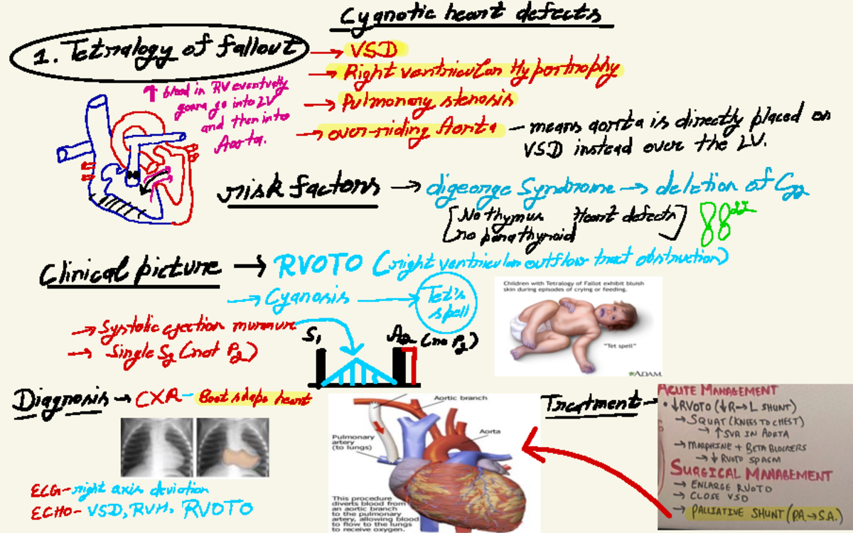 Cyanotic Heart Defects - cyanotic heart defects · Tetralogy of fallout ...