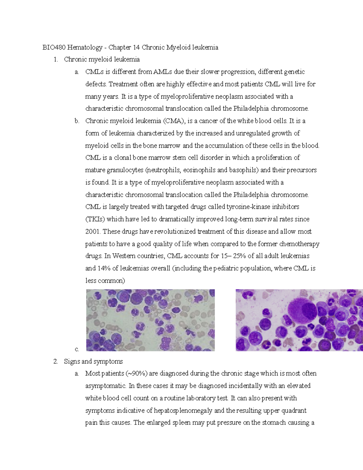 BIO480 Hematology - Chapter 14 Chronic Myeloid leukemia - CMLs is ...