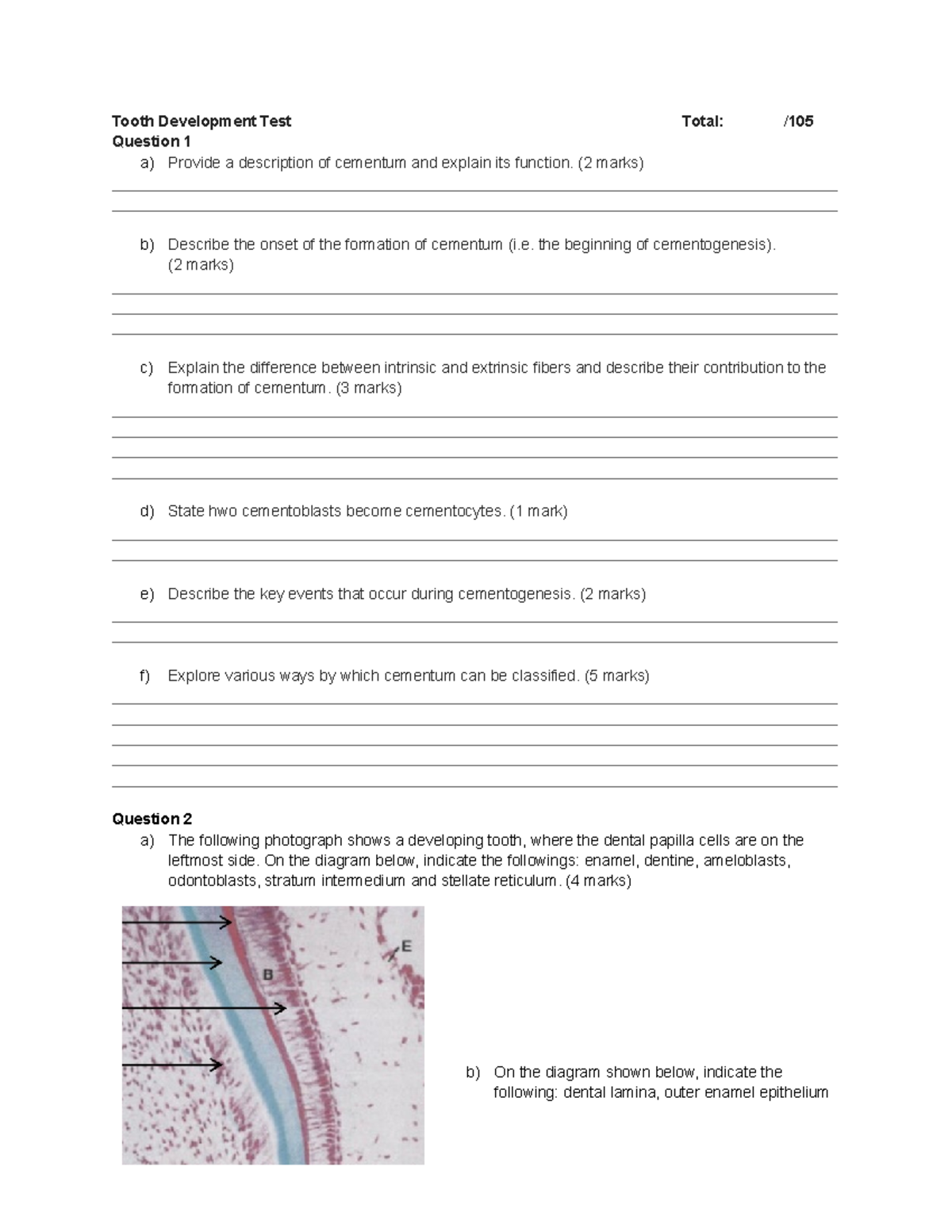 Tooth Development Test - (2 marks) b) Describe the onset of the ...