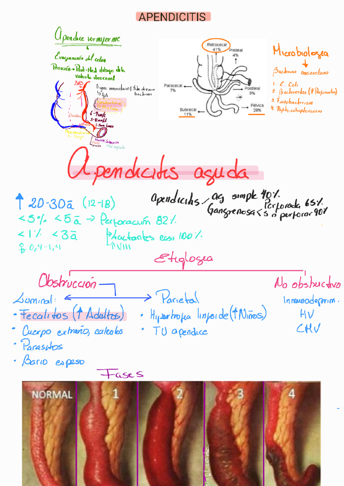 5 Apendicitis 240403 160405 - APENDICITIS Apendace vermiforme ...