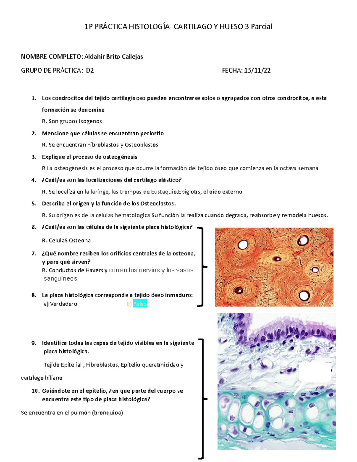 Aldahir Brito Examen 3 Histologia - 1P PRÁCTICA HISTOLOGÍA- CARTILAGO Y ...