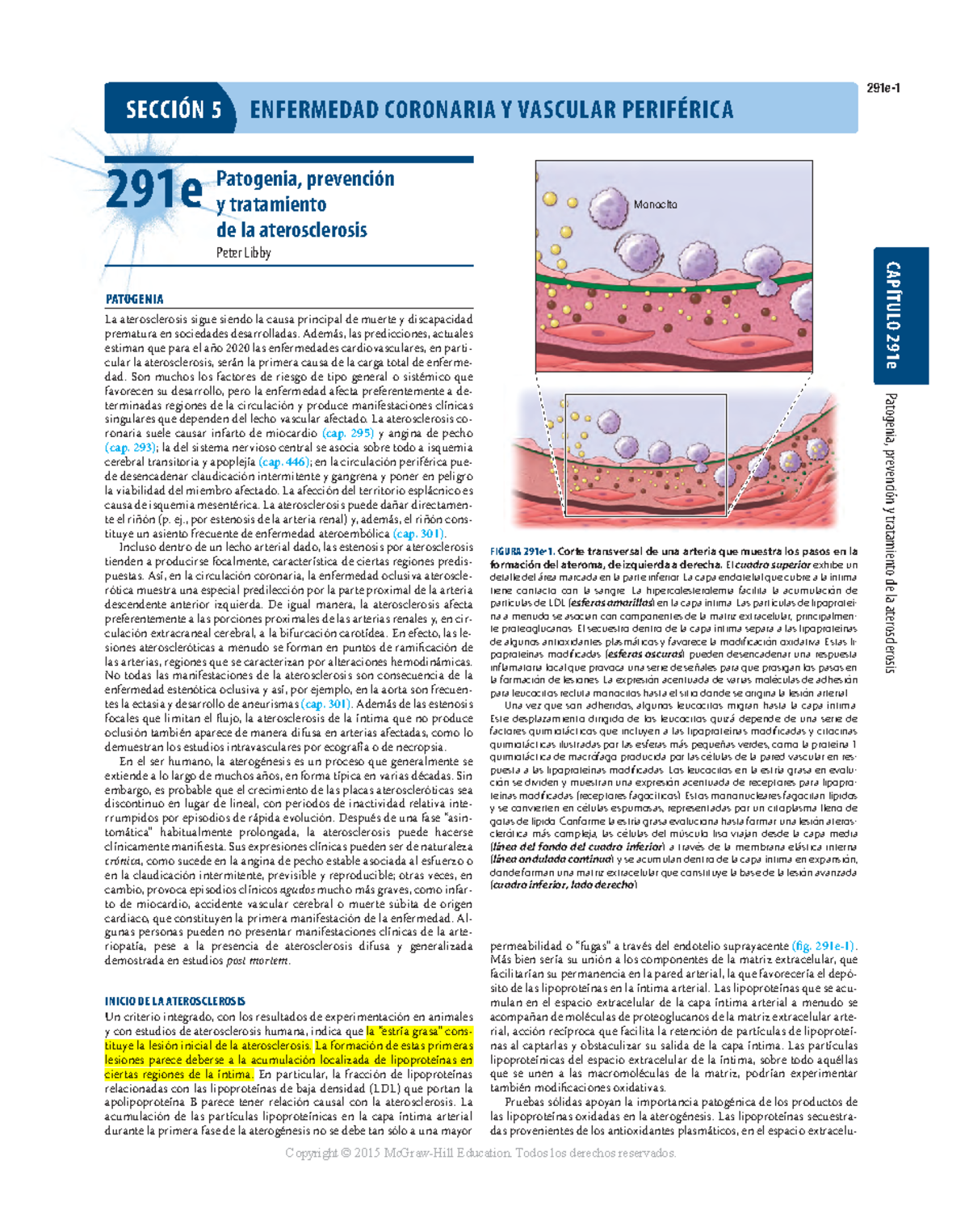 pasos de formación de placa de aterosclerosis