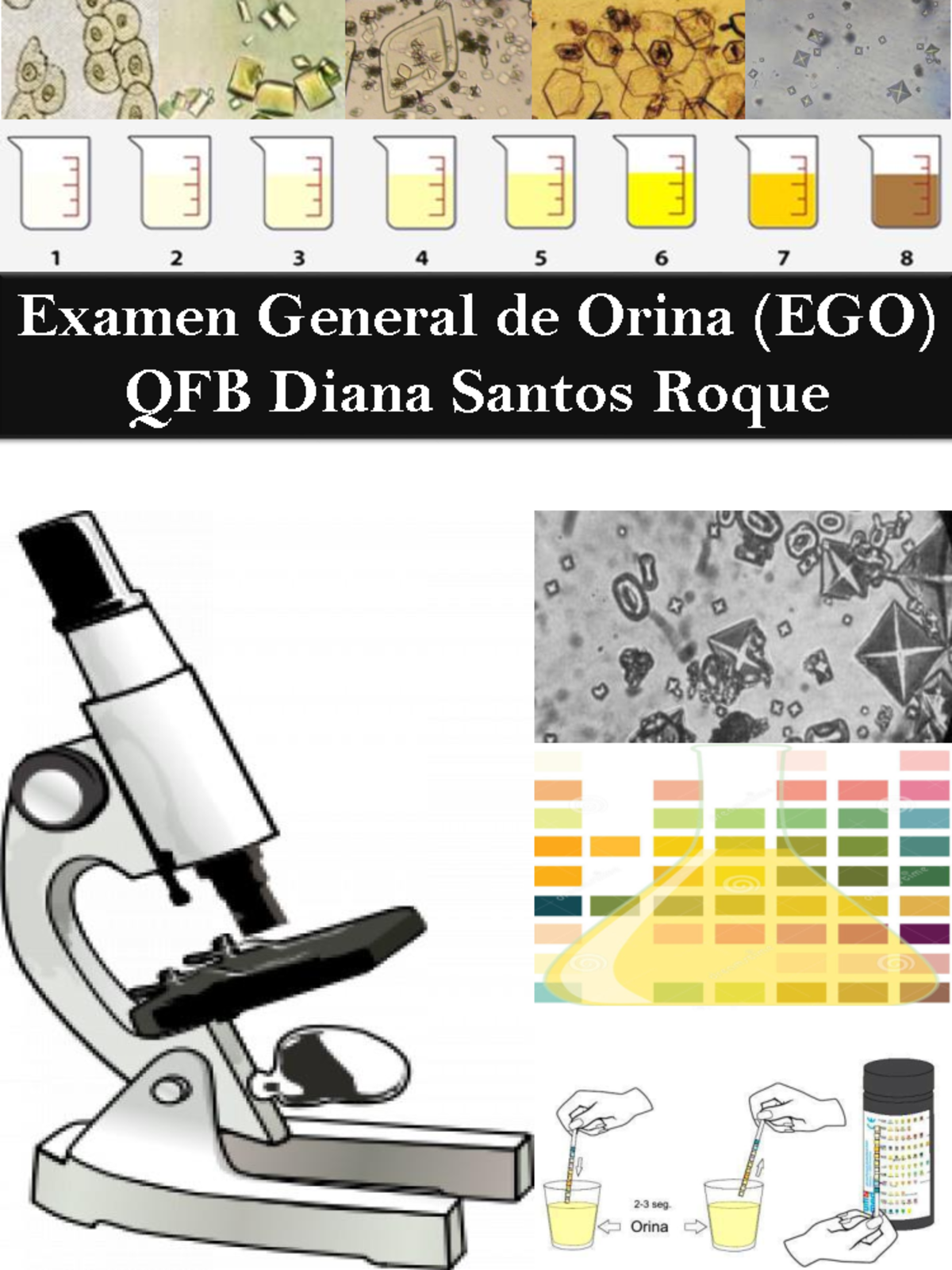 Ego Apuntes Examen General De Orina Ego Qfb Diana Santos Roque Definicion La Orina Es