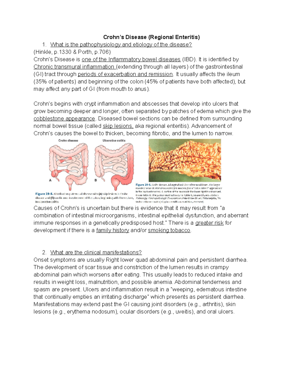 Crohn's Disease Notes Crohn’s Disease (Regional Enteritis) What is
