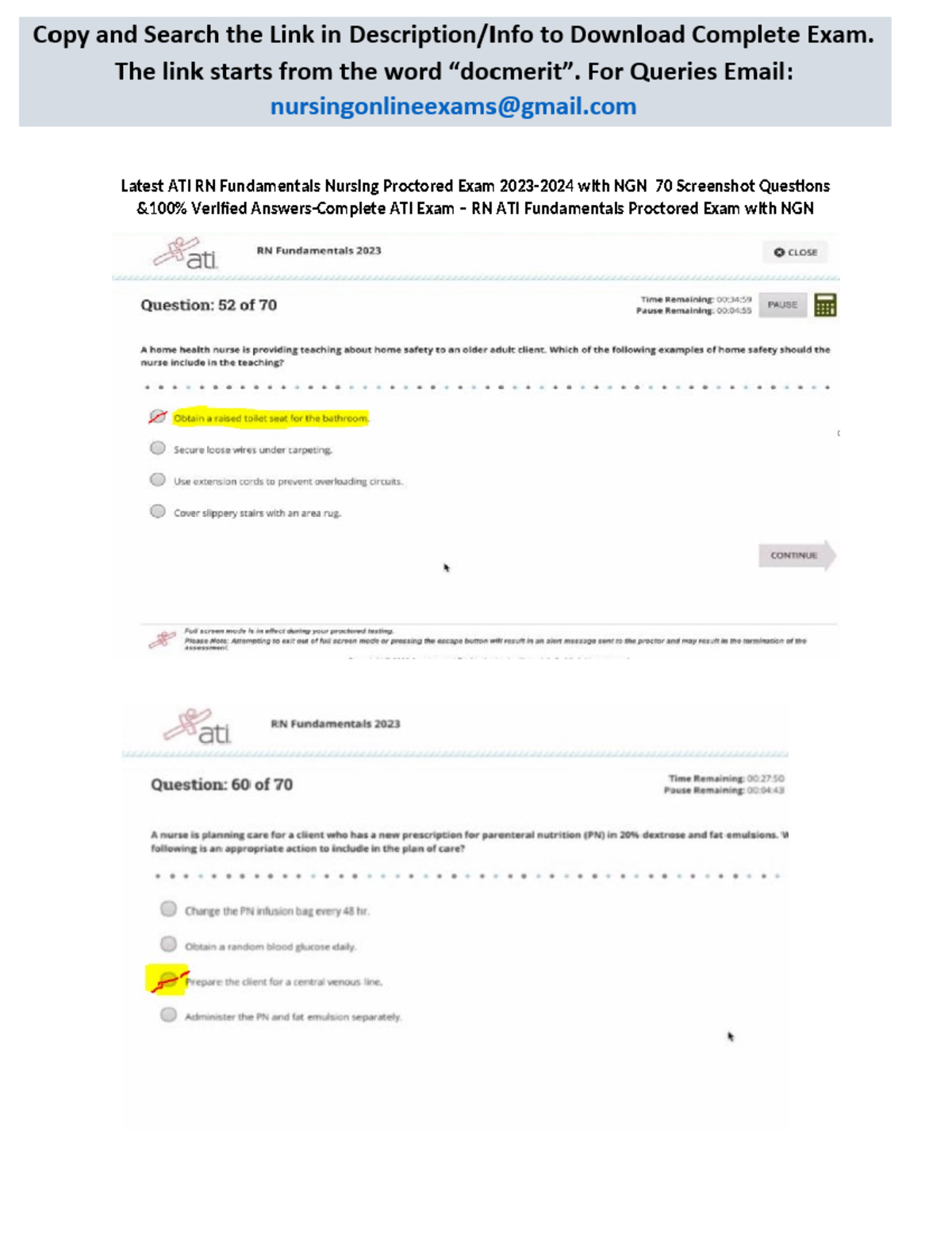 Latest ATI RN Fundamentals Nursing Proctored Exam 2023-2024 with NGN 70 ...