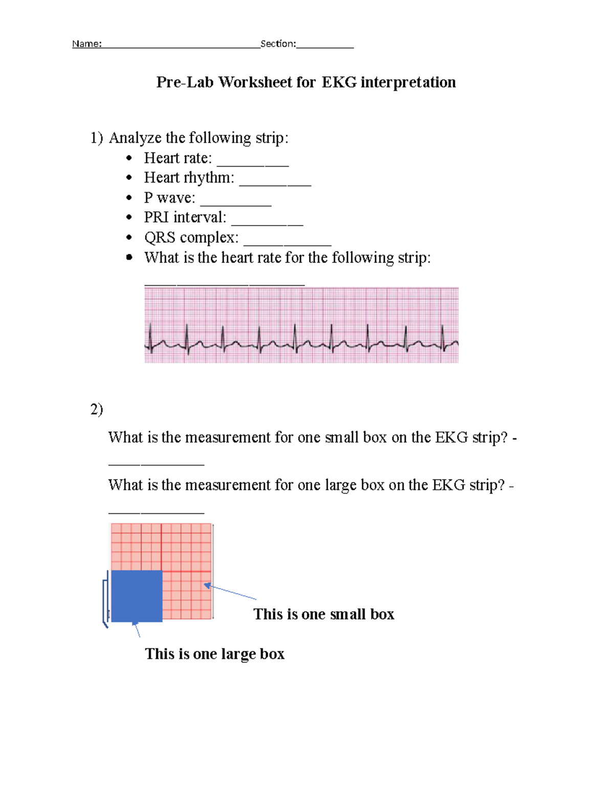 EKG Prelab worksheet notes Name Section PreLab Worksheet for