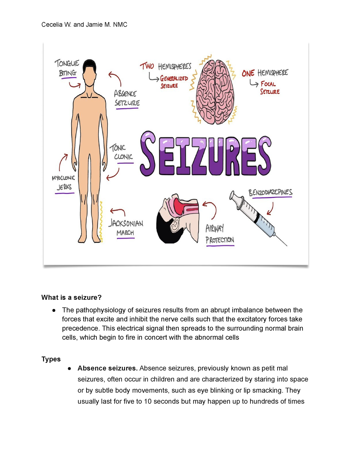 Seizures Med Surg What Is A Seizure The Pathophysiology Of Seizures Results From An Abrupt 0100