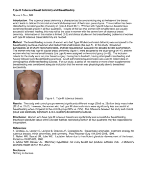 Paper 24147 2 - good luck - Type III Tuberous Breast Deformity and