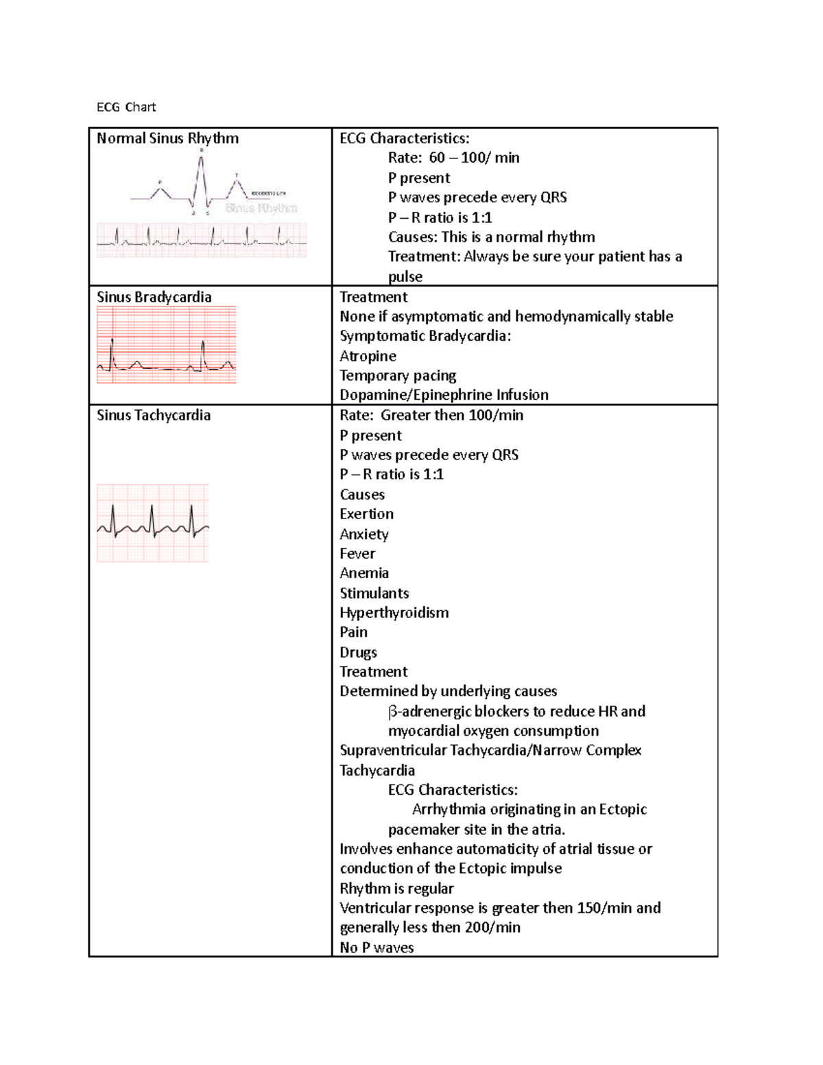 ECG Chart - Quick Reference Guide - ECG Chart Normal Sinus Rhythm ECG ...