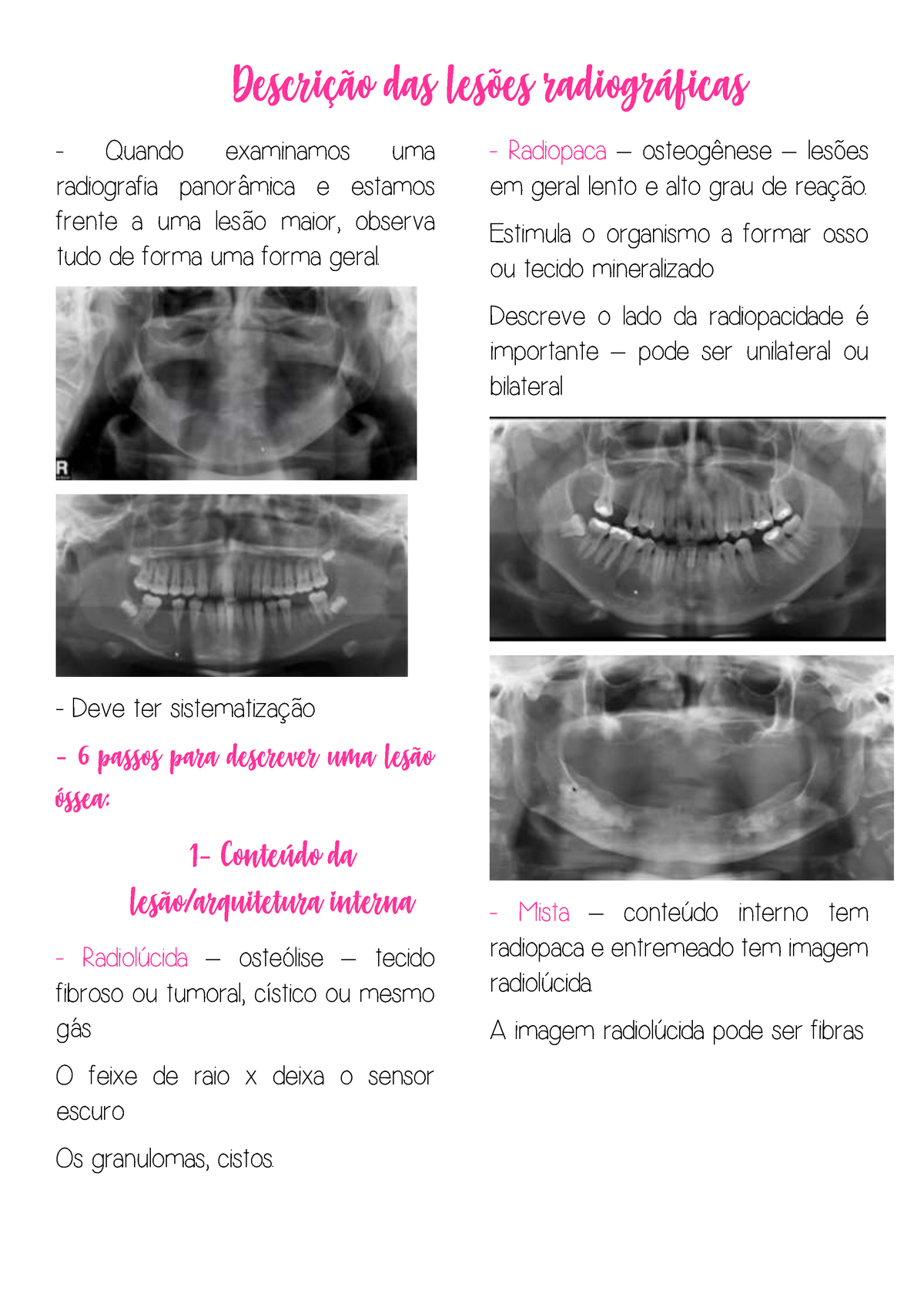 Radiografia Panorâmica da mandíbula não evidencia lesões sugestivas de