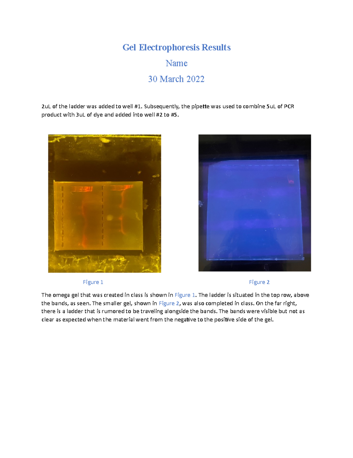 Gel Electrophoresis Result Important Gel Electrophoresis Results Name March Ul Of