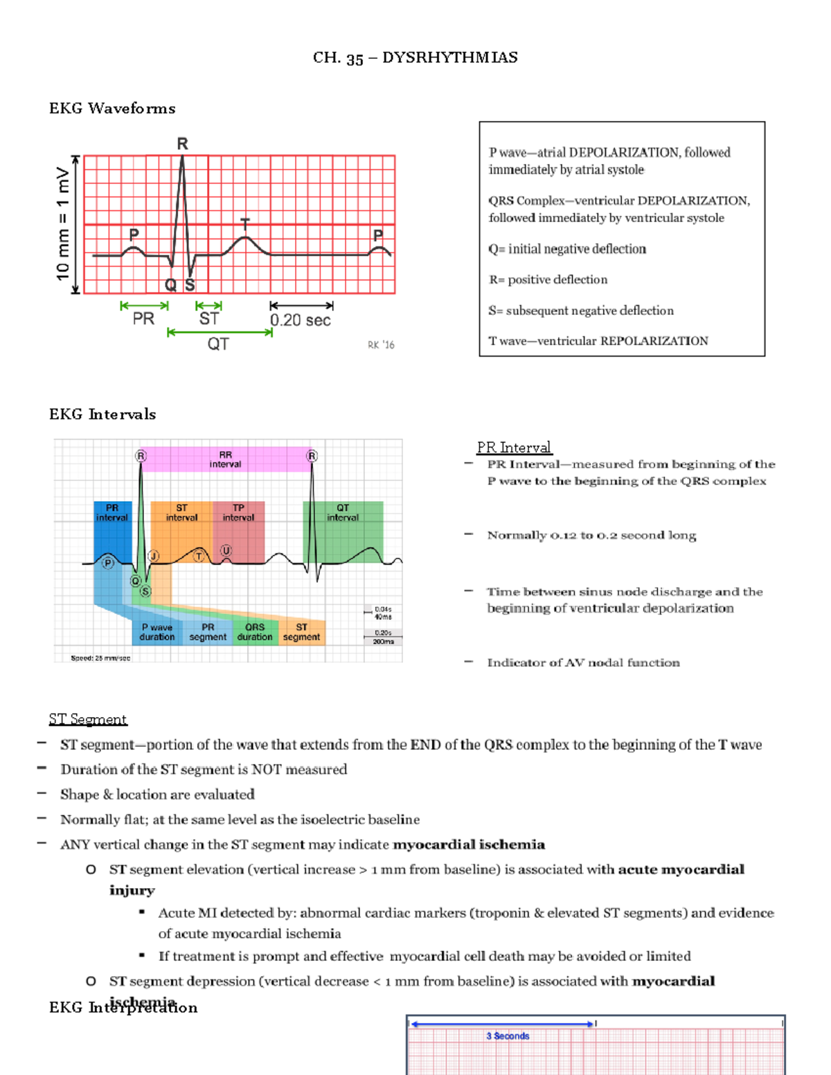 Dysrhythmias lecture notes - CH. 35 – DYSRHYTHMIAS EKG Waveforms EKG ...