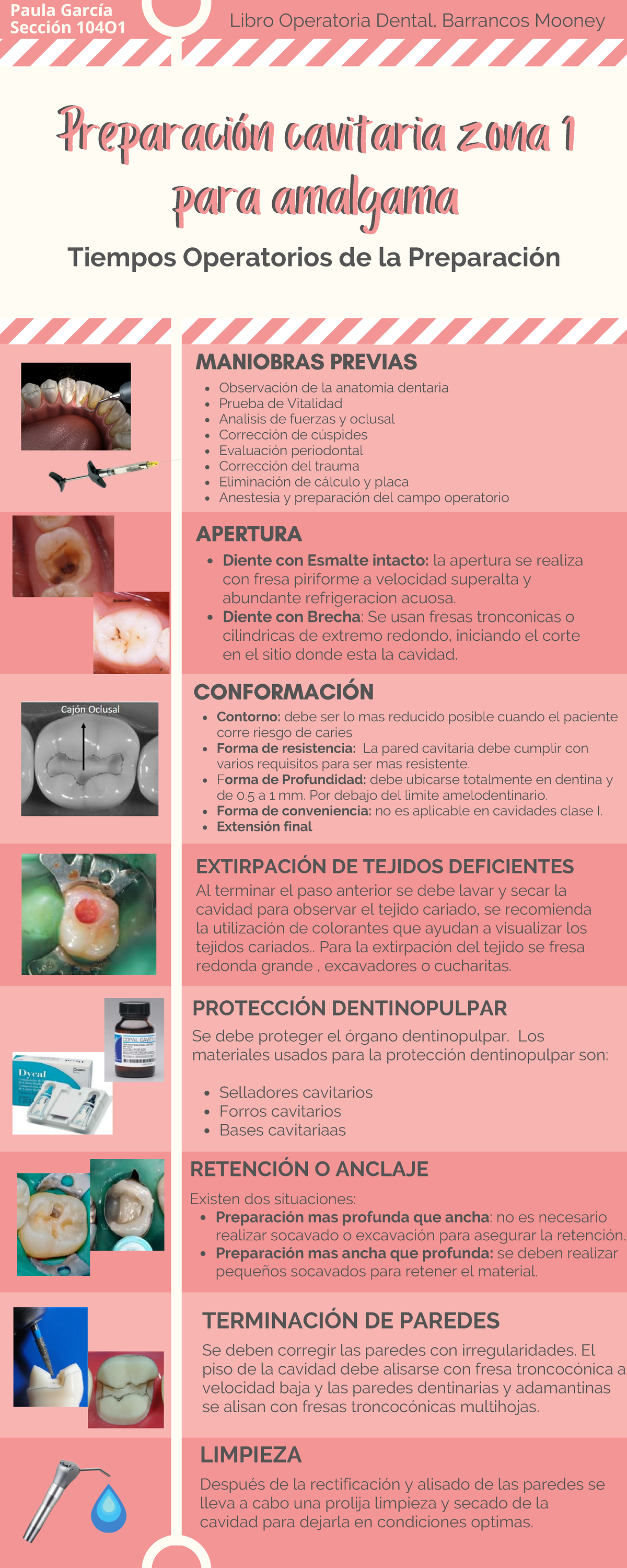 Amalgama - Preparación cavitaria zona 1 para amalgama Tiempos ...