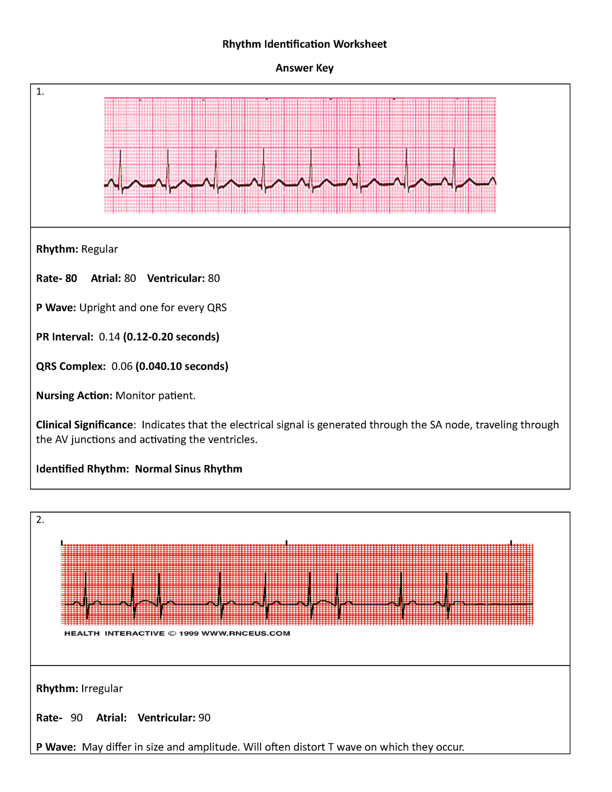 Ekg Rhythm Identification Worksheet Rhythm Identification Worksheet