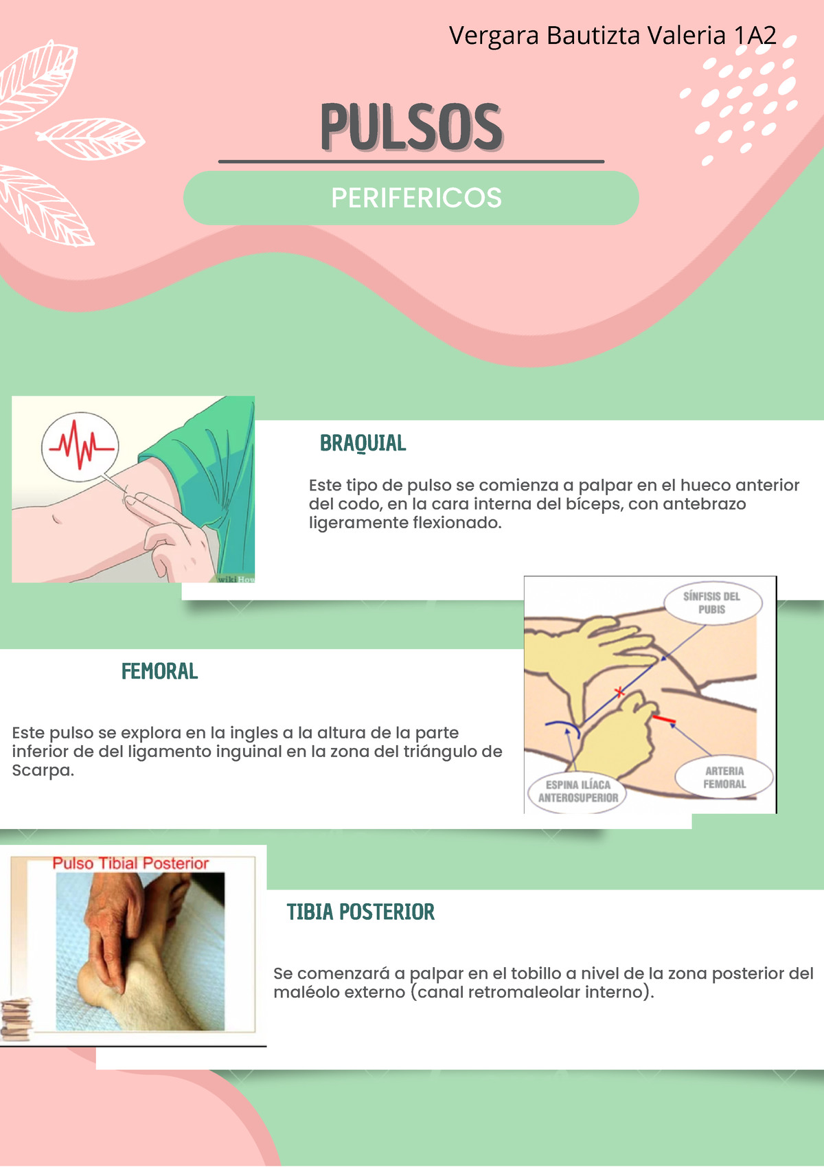 Pulsos Perifericos - Definiciones - PULSOSPULSOS PERIFERICOS Este Tipo ...