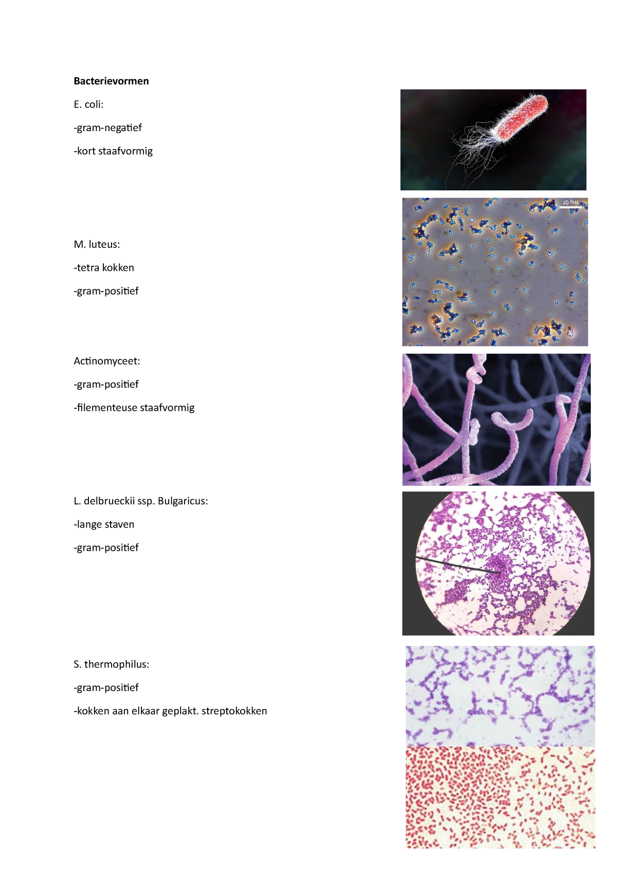 bacterievormen-gramkleuring-bacterievormen-e-coli-gram-negatief