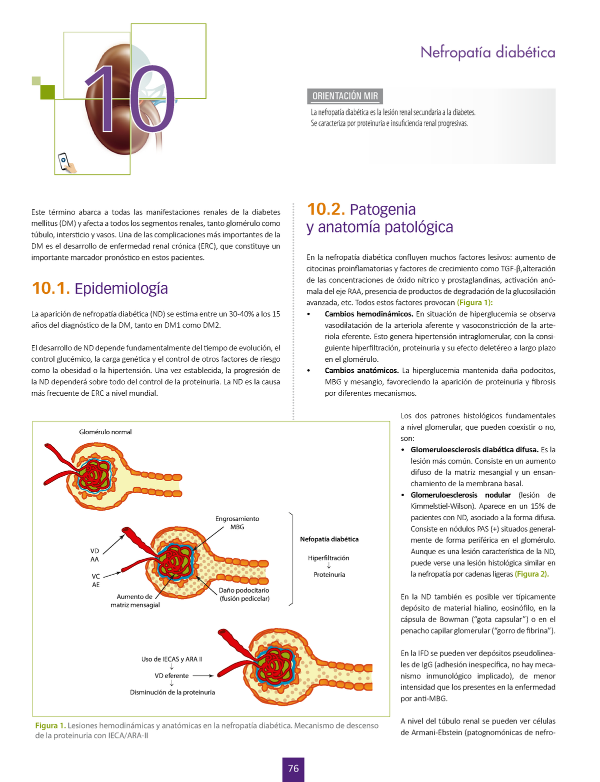 Nefropatia Diab Tica Endocrinologia Complicaciones De La Diabetes