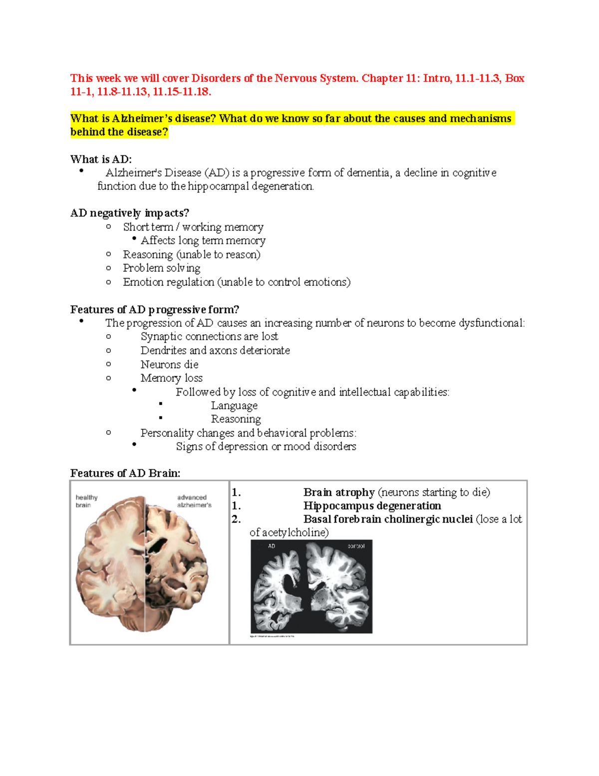 Brain Disorders, Chpt 11 - This week we will cover Disorders of the ...