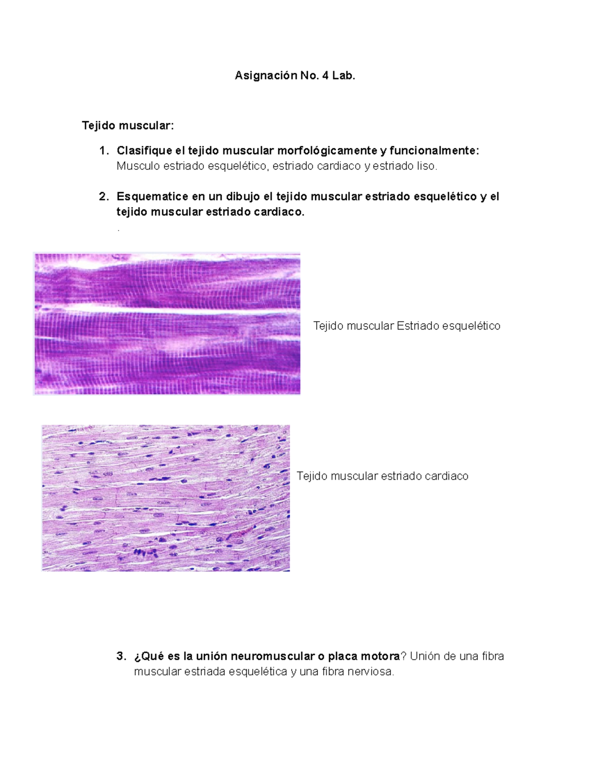 dibujo del tejido muscular cardiaco