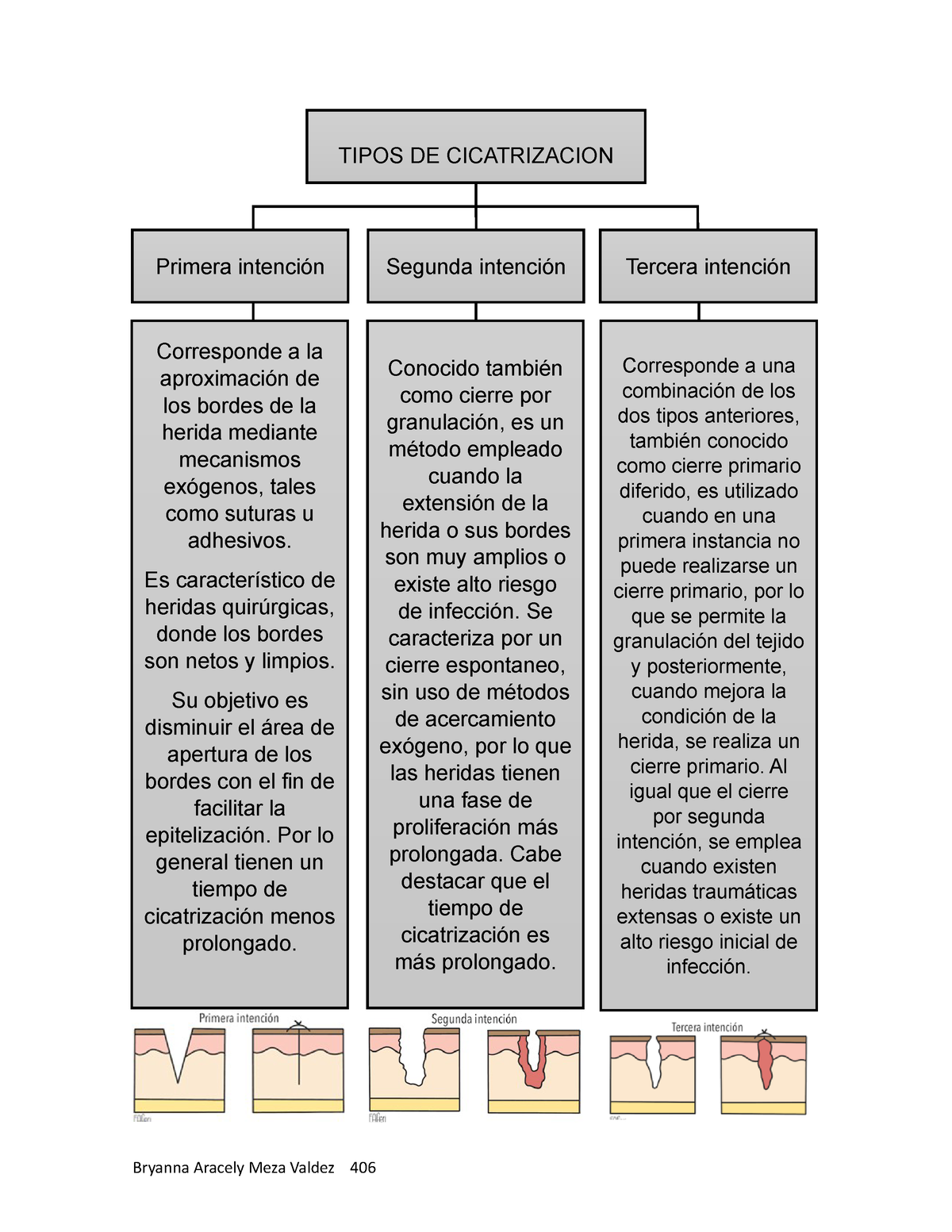 Tipos DE Cicatrizacion - Bryanna Aracely Meza Valdez 406 Corresponde a la  aproximación de los bordes - Studocu