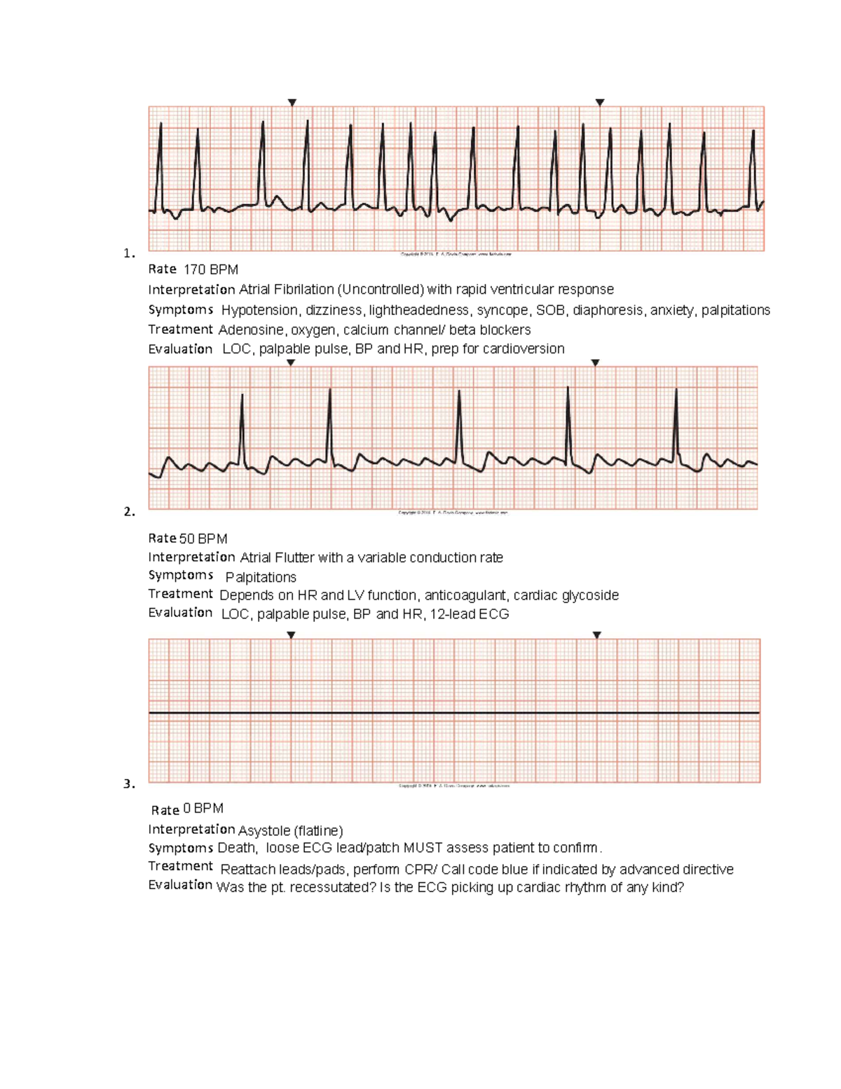 EKG Worksheet - Rate Interpretation Symptoms Treatment Evaluation 2 ...