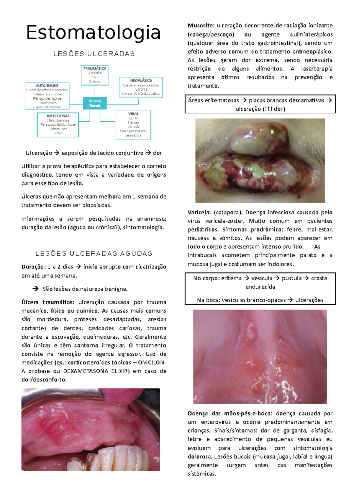 Lesões Ulceradas Estomatologia LESÕES ULCERADAS Ulceração exposição de tecido conjuntivo dor Lesões Ulceradas Estomatologia LESÕES ULCERADAS Ulceração exposição de tecido conjuntivo dor