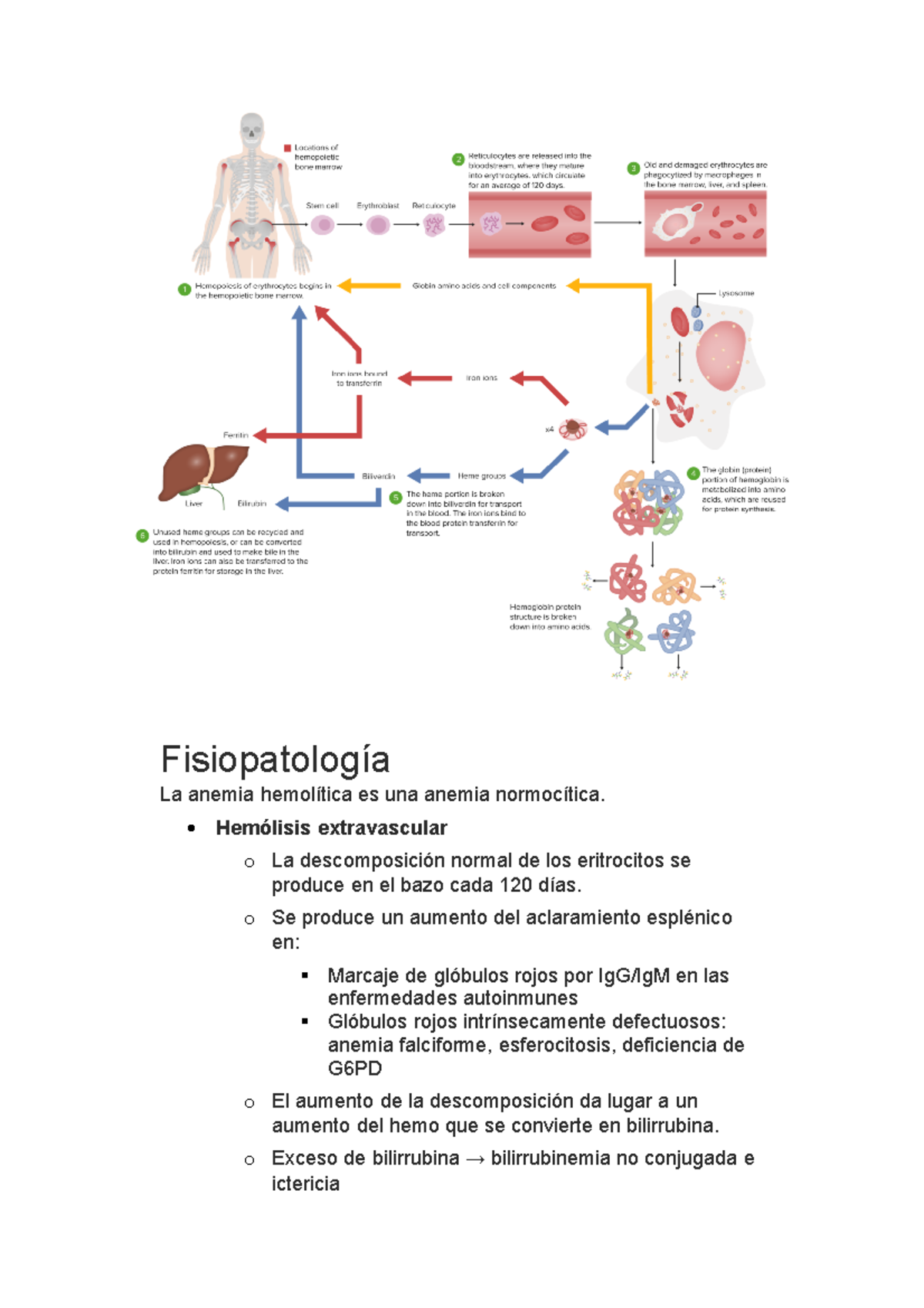 Anemia hemolitica - Fisiopatología La anemia hemolítica es una anemia ...