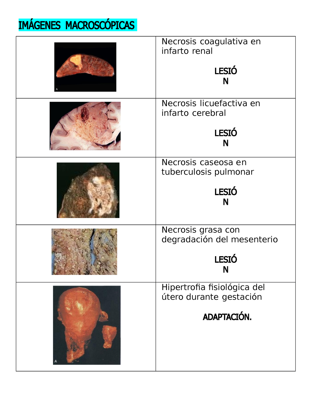 mama con necrosis grasa