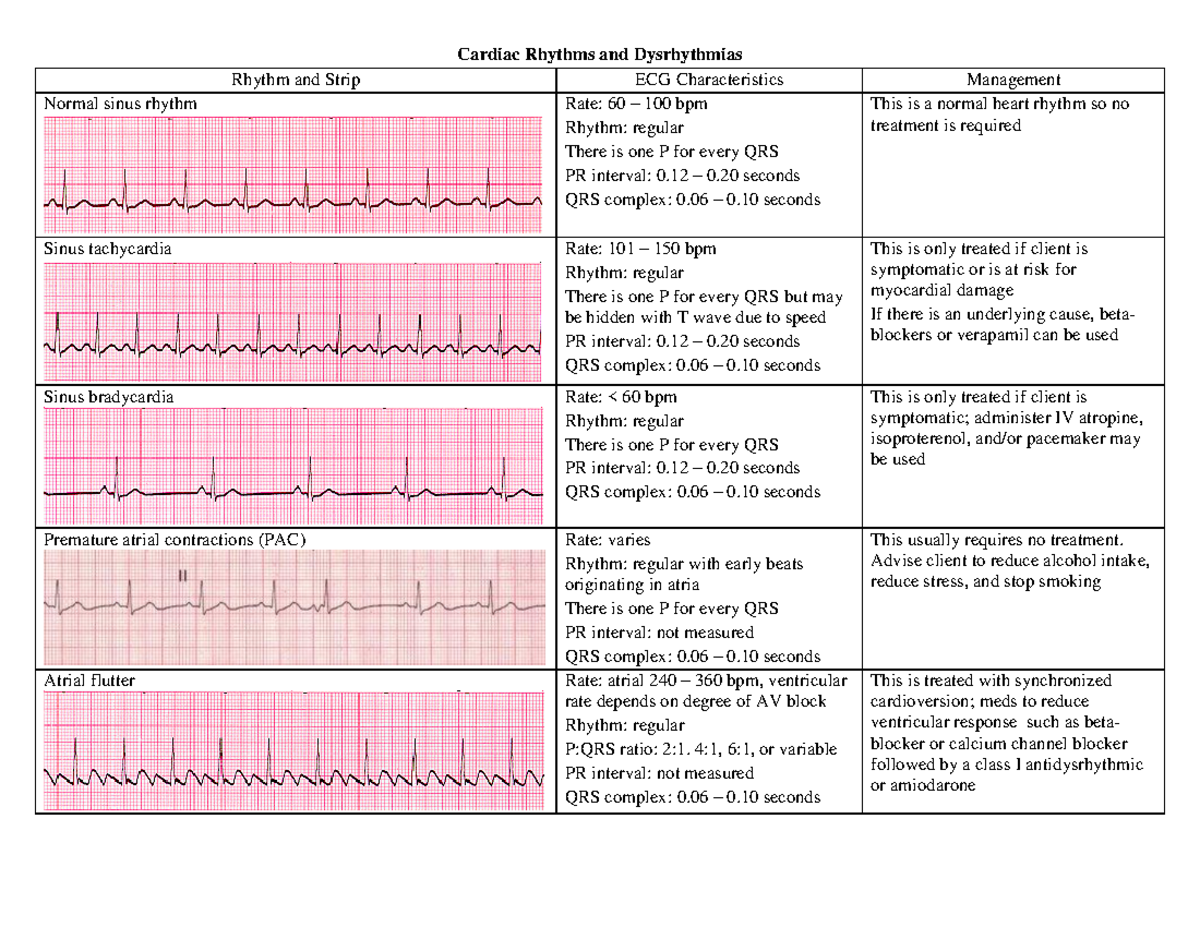 Cardiac-Dysrhythmias - Cardiac Rhythms and Dysrhythmias Rhythm and ...