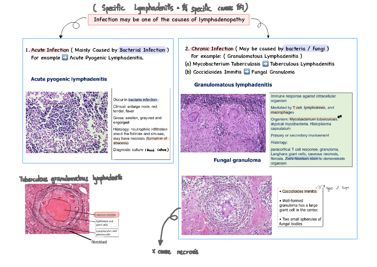 Non Specific Reactive Lymphadenitis Means