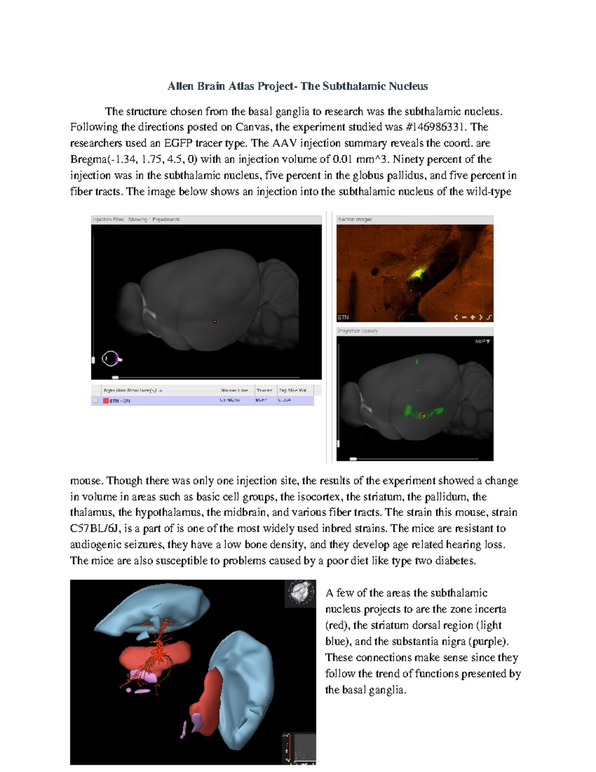 Allen Brain Atlas Project - Allen Brain Atlas The Subthalamic Nucleus ...
