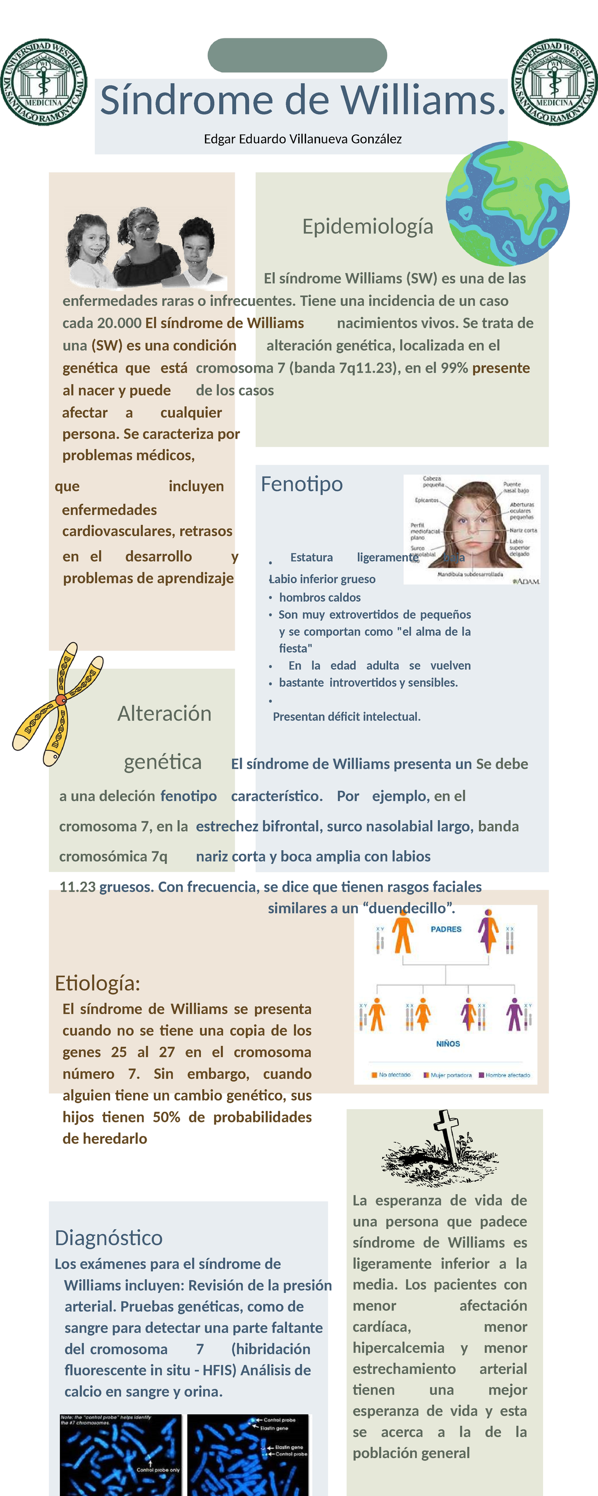 Síndrome de Williams - Genética medica. Síndrome de Williams. Edgar ...