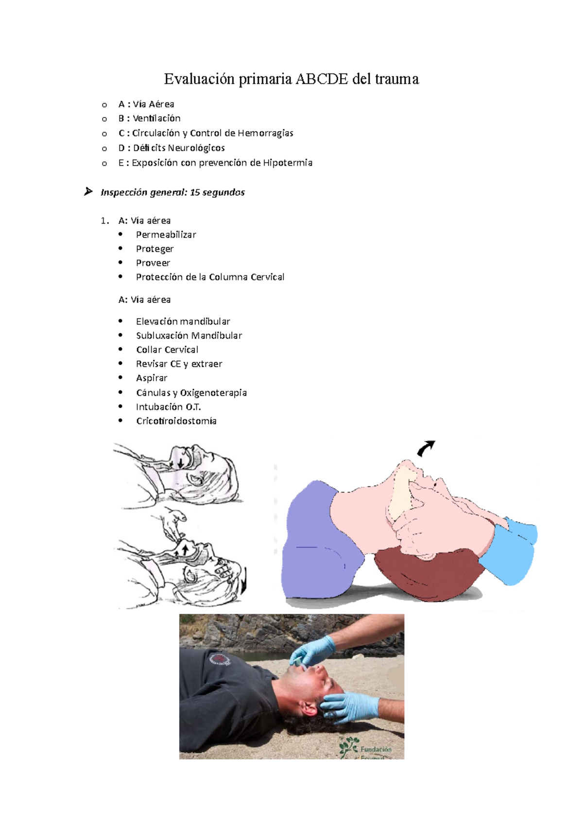 Evaluaci n Primaria ABCDE Del Trauma Cricotiroidostom a B 