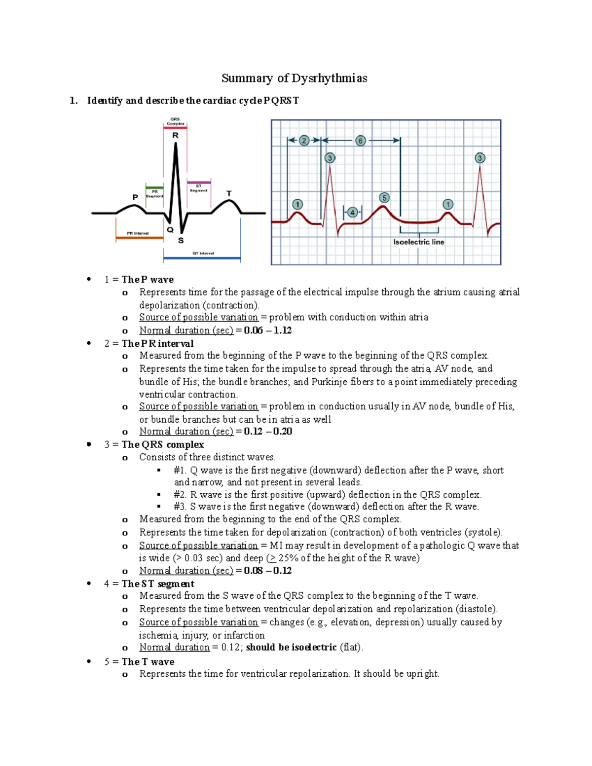 Dysrhythmia Study Guide (condensed) - Summary Of Dysrhythmias Identify ...